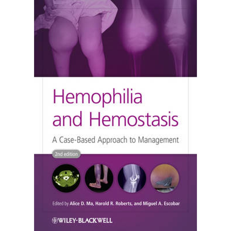 Hemophilia and Hemostasis: A Case-Based Approach to Management, 2nd Edition